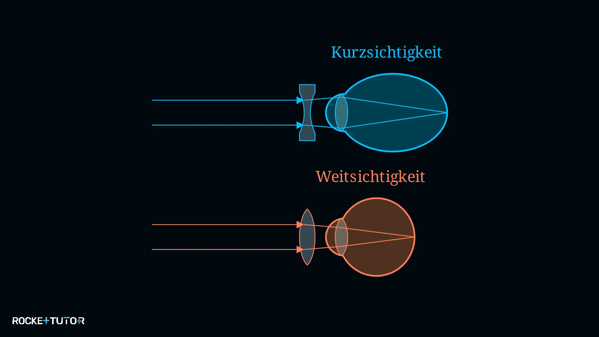 Korrektur durch Sammellinse und Zerstreuungslinse