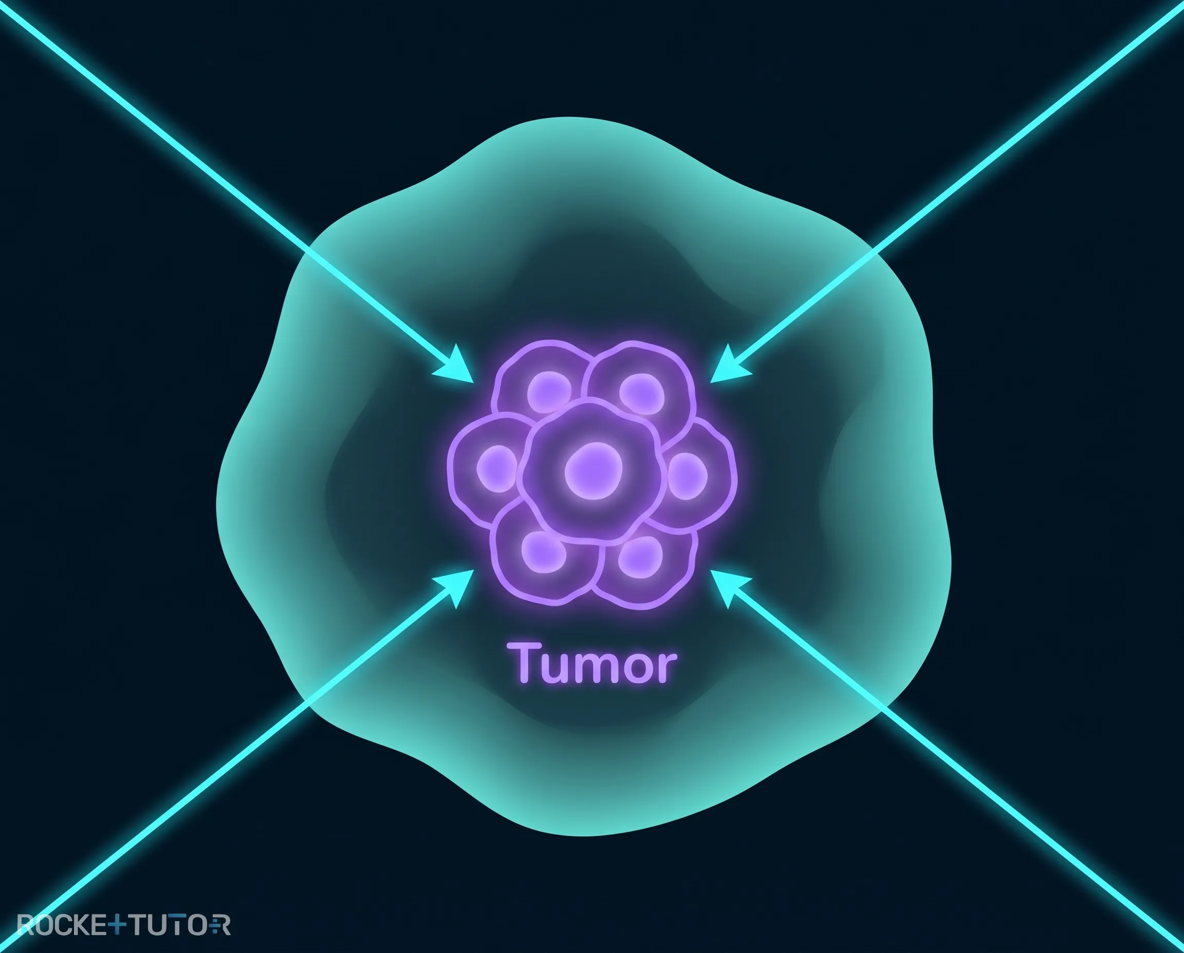 Strahlentherapie bei einem Tumor